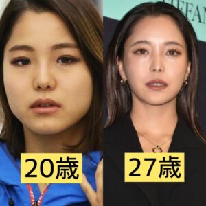 【顔画像】高梨沙羅の整形前は別人すぎる！時系列でみると衝撃の変化！